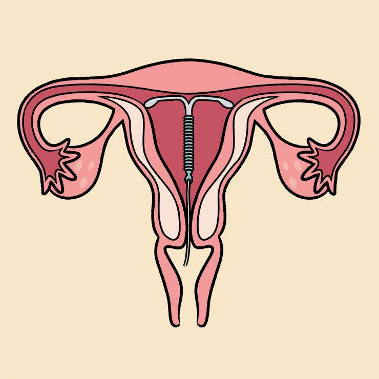 뻔한 콘돔 대신 쉽게 피임할 수 있는 방법 4