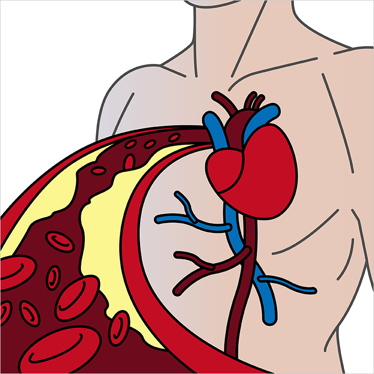 겨울 불청객 수족냉증을 일으키는 원인